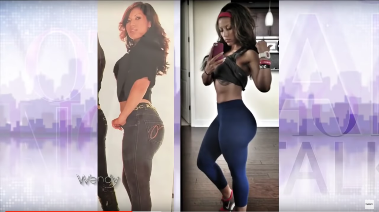 Fitness Instagrammer Sues South Florida Plastic Surgeon for Botched Butt-Injection Removal