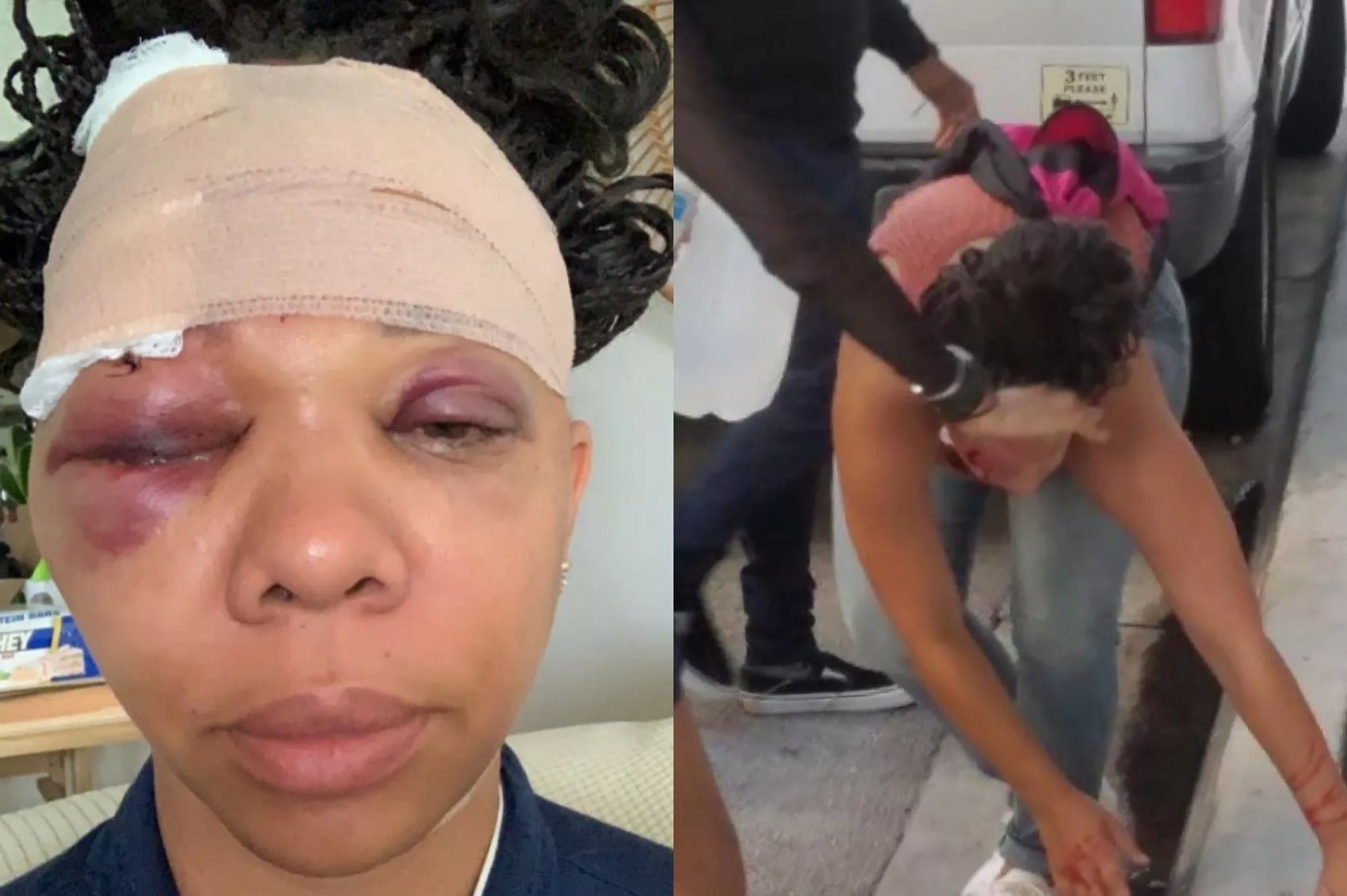 Woman Struck by Rubber Bullet While Protesting Police Brutality Sues City of Fort Lauderdale